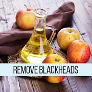 How to Remove Blackheads
