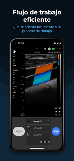 MediExpert - SonoExpert Screen 3