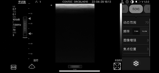 CMS1600-VET Screen 2