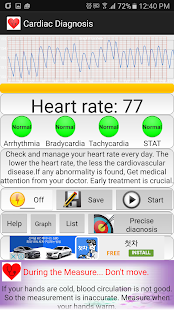 Cardiac diagnosis (arrhythmia) 146 Screenshots 2