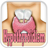 Hypothyroidism Disease icon