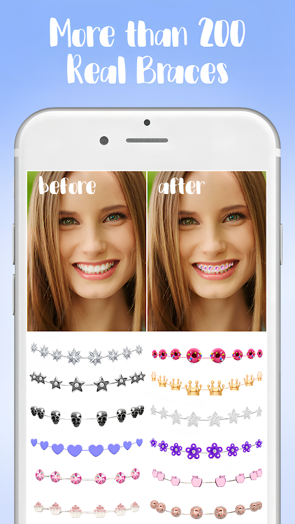 Braces - New - (Android)