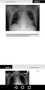 Medical X-Ray Interpretation with 100+ Cases(圖5)-速報App