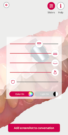 3Shape Communicate Screen 2