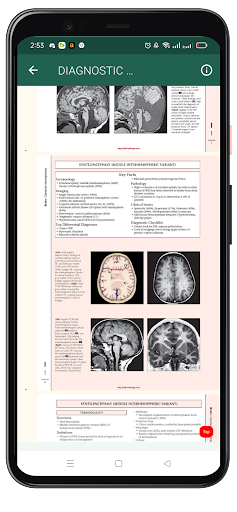 Diagnostic Neuroradiology