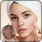 Pimple Remover : Beauty Plus icon