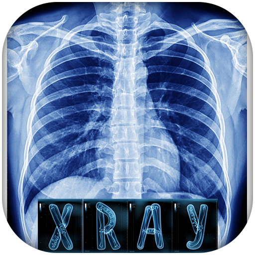 Normal Ankle Joint X Ray Stock Image U12590773 Fotosearch