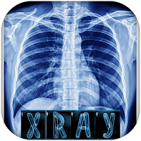 X Ray scanner interpretaion