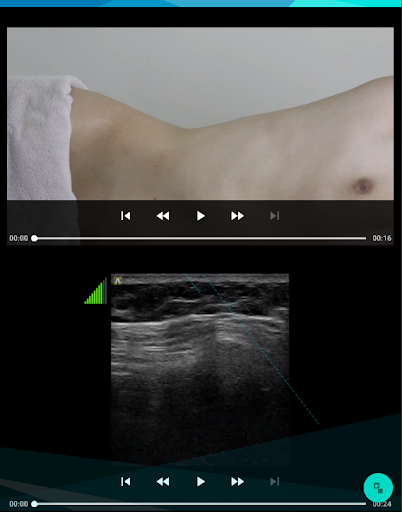 초음파 유도하 침 시술 가이드북 Screen 3