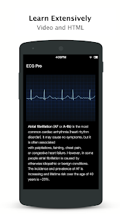 ECG Pro - Real World ECG / EKG Cases Screenshot