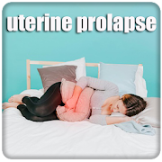Top 2 Health & Fitness Apps Like Uterine Prolapse - Best Alternatives