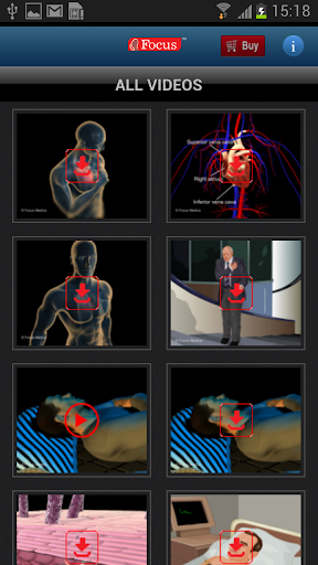 FAQs in Heart Failure