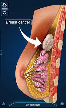 Breast Anatomy Pro.のおすすめ画像5
