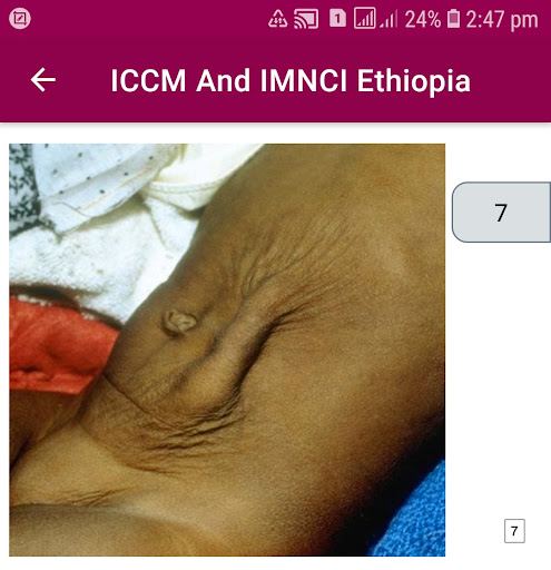 ICCM and IMNCI 2021 Ethiopia Screen 3