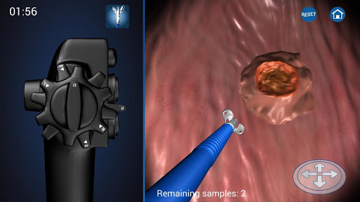 Endoscopy 3D Free