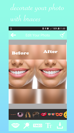 Android application Braces Booth Stickers photo ed screenshort