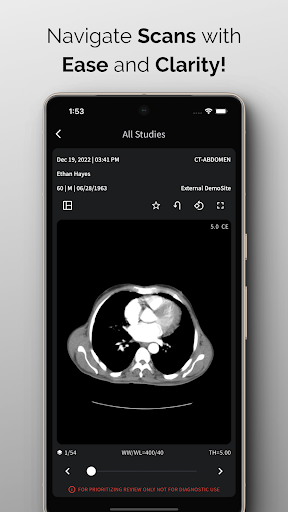 NeuroView Screenshot 1 - AppWisp.com