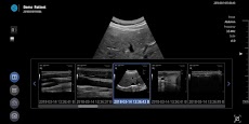 SONON X Ultrasound Appのおすすめ画像2