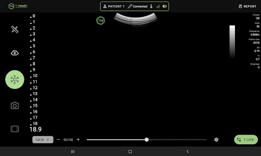 Android application T-Scope View Lite screenshort