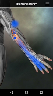 Muscle Trigger Point Anatomy Screenshot