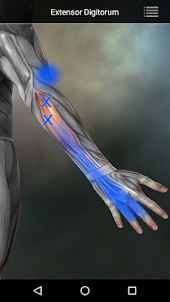 Muscle Trigger Point Anatomy