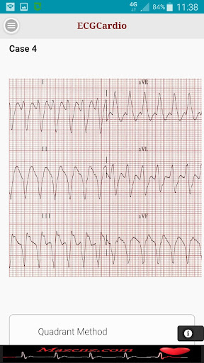 ECGCardio Screen 3
