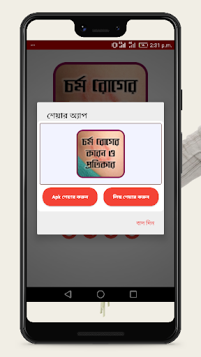 চর্মরোগের কারণ ও কার্যকরী প্রতিকার-Skin Diseases