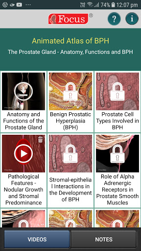 Animated Atlas of BPH Screen 2