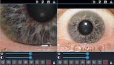 Eye Diagnosisのおすすめ画像5