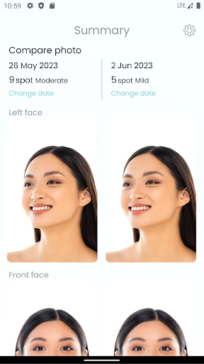 Acne Byebye - AI Skin Diary Screen 3