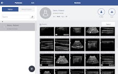 SONON X Ultrasound Appのおすすめ画像4