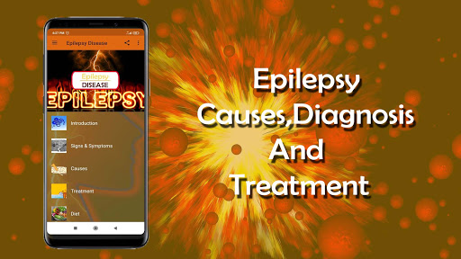 Epilepsy - Causes, Diagnosis, and Treatment