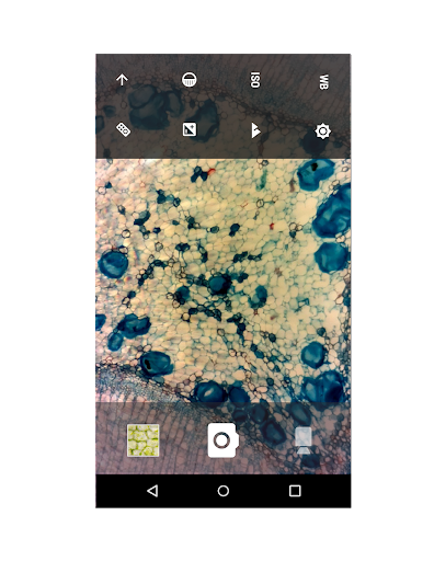 eScope Screen 3