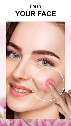 Pimple Remover Photo Editor Screen 2