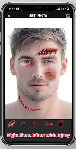 Fight Photo Editor With Injury