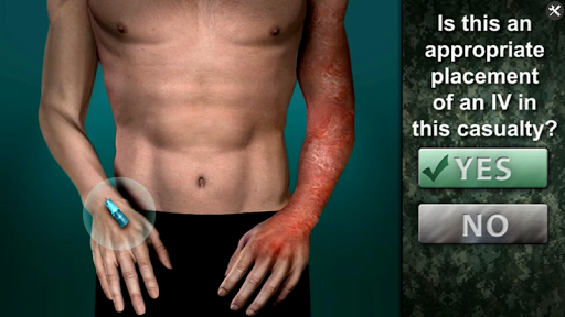 Medrills Army Saline Lock