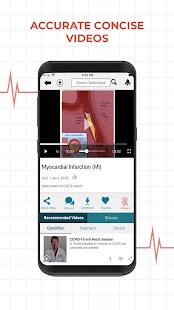 CardioVisual: Heart Health App Screenshot