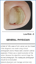 Model Dermatol  -  Skin Disease