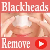 Blackheads And Whiteheads Remove App Videos icon