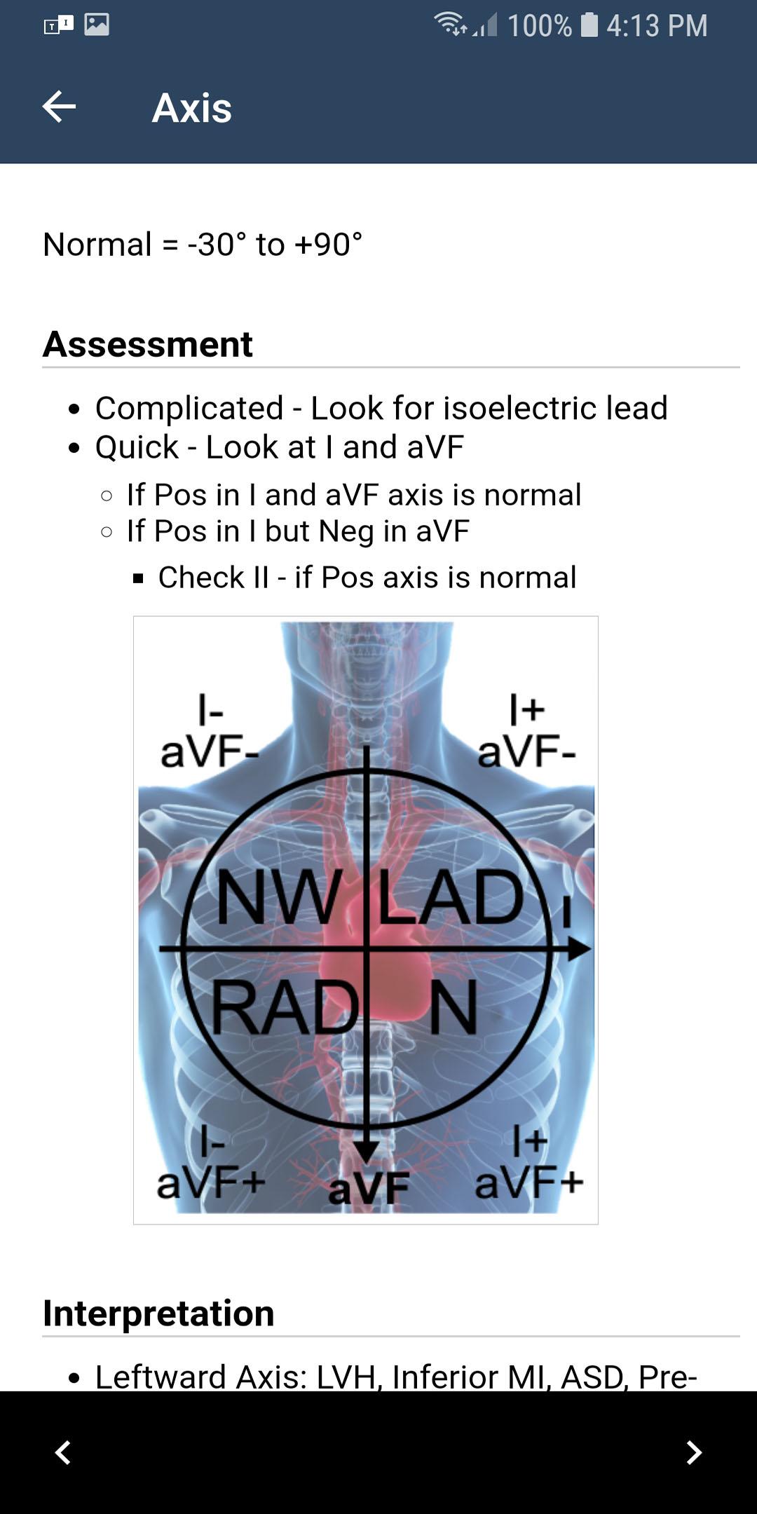 Android application ECG Guide by QxMD screenshort