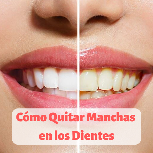 Cómo Quitar Manchas en los Dientes