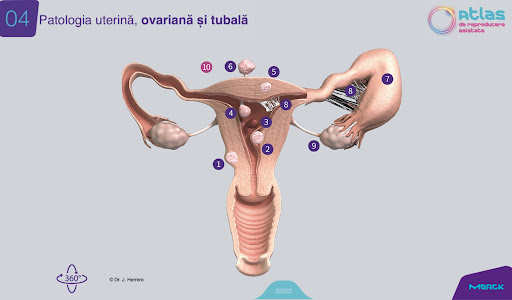 Atlas RA - MERCK Screen 3