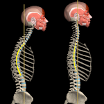 Kyphosis & Rounded Back by Muscle and Motion Apk