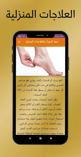 علاج مسمار القدم