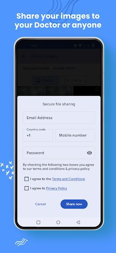 MouthCAM - Intraoral Camera