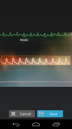 Capstesia App Anesthesia Screenshot 3 - AppWisp.com