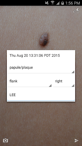 Android application Dermcam screenshort