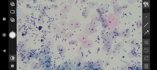 Cilika View Screen 3