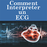 Comment Interpreter un ECG icon