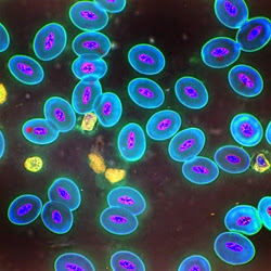 Tracie “tls65” Schissel